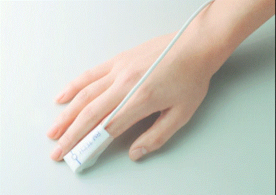 BM-400 Series - Pediatric Disposable pulse oximetry (SpO2) sensor